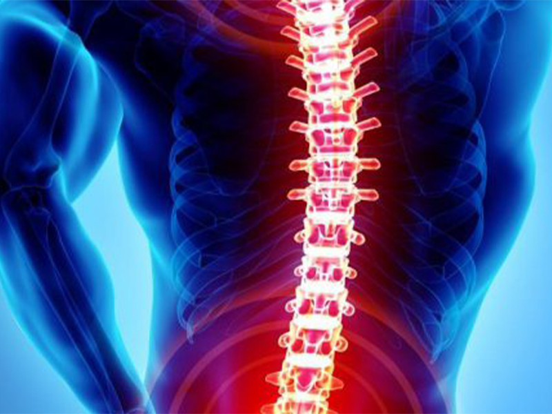 جراحی ستون فقرات