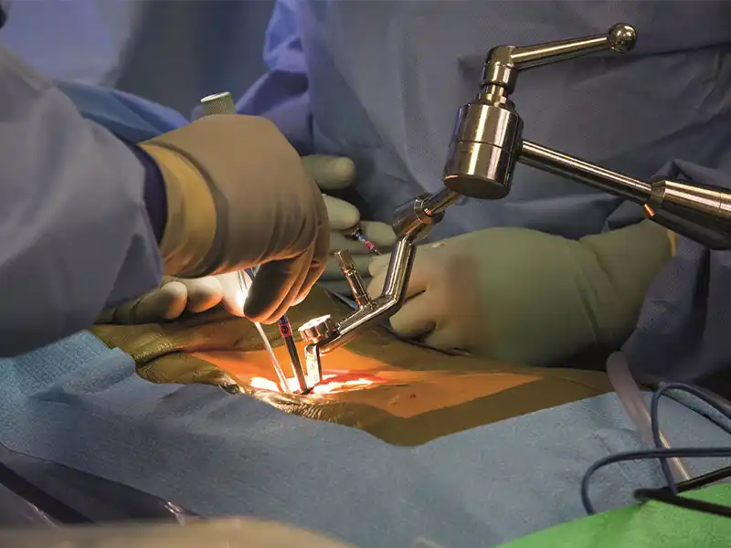 عوارض عمل جراحی ستون فقرات