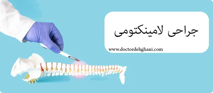 جراحی لامینکتومی برای تنگی کانال