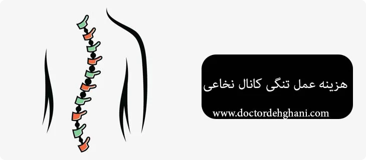 قیمت عمل تنگی کانال نخاعی