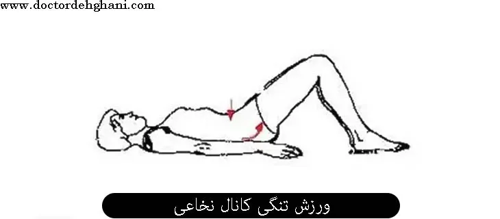 ورزش های تنگی کانال نخاعی