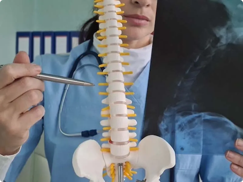 اسکولیوز مادرزادی