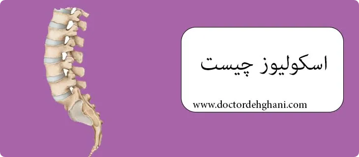 اسکولیوز چیست
