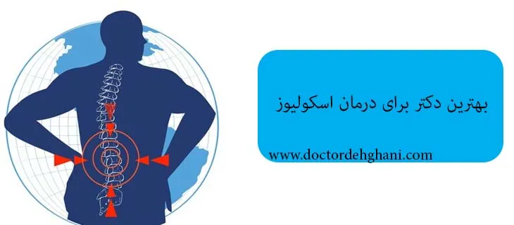 بهترین دکتر درمان اسکولیوز در کرج
