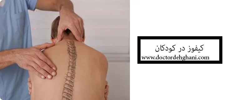 کیفوزیا گوژپشتی در کودک چیست