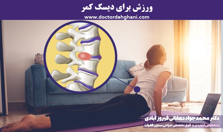 ورزش برای دیسک کمر