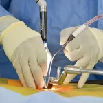 مدیریت هزینه عمل دیسک گردن با لیزر