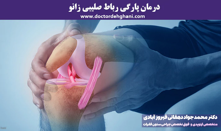 درمان پارگی رباط صلیبی زانو
