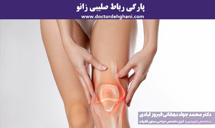 پارگی رباط صلیبی زانو