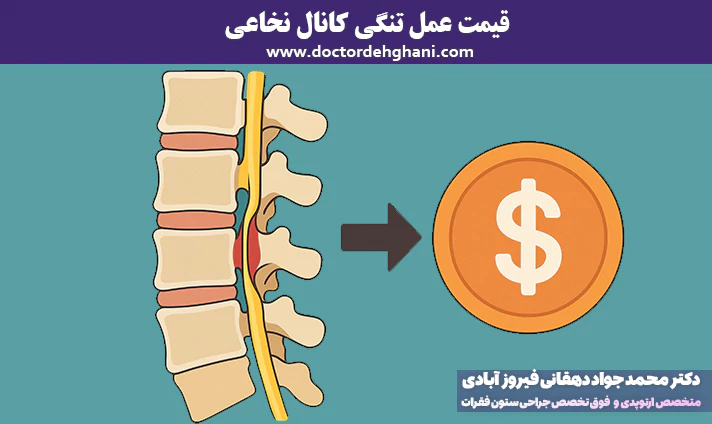 قیمت عمل تنگی کانال نخاعی